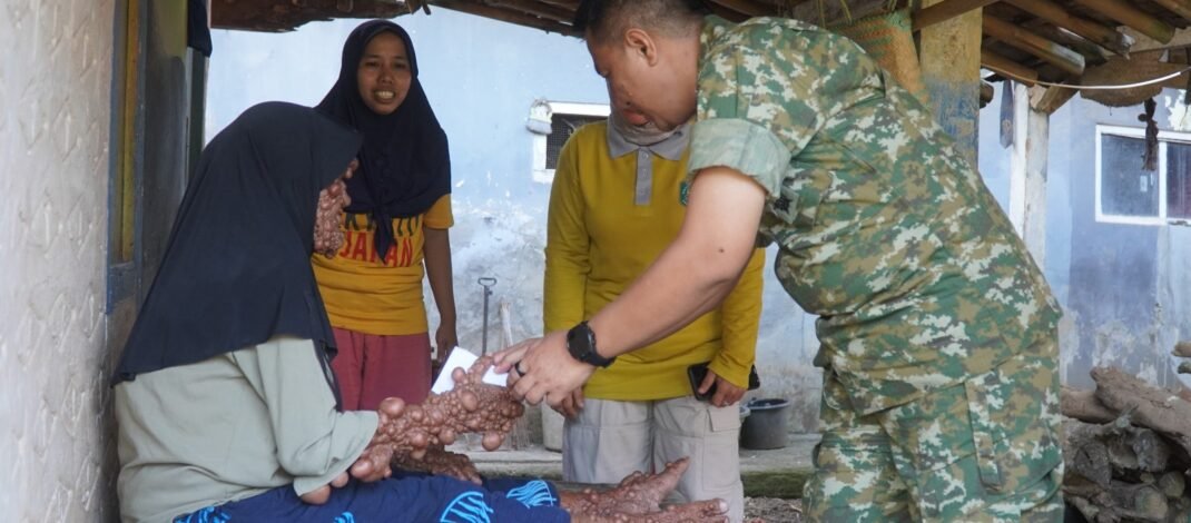 Kepedulian di Hari Jadi ke-78 Subang, Dandim 0605/Subang Berikan Bantuan kepada Warga Penderita Penyakit Kulit