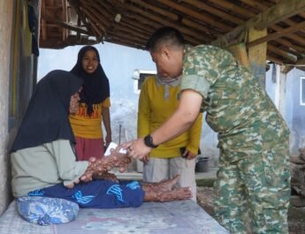 Kepedulian di Hari Jadi ke-78 Subang, Dandim 0605/Subang Berikan Bantuan kepada Warga Penderita Penyakit Kulit